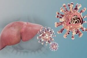 Экспертное мнение: что нужно знать о гепатите прямо сейчас