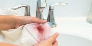 Как отстирать кровь при менструации: лайфхаки для «этих дней»